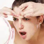 Prevent Breakouts After Exercise