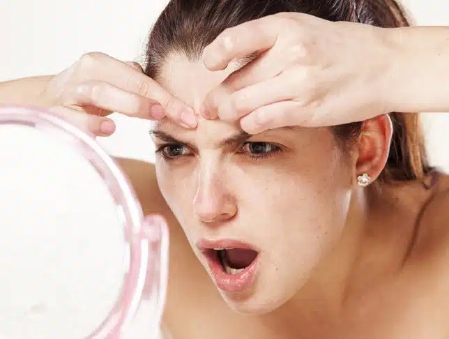 Prevent Breakouts After Exercise