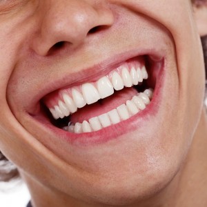 Emotional and Physical Consequences of Tooth Decay by simplydentalchatswood.com.au