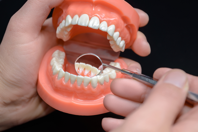 Different Types Of Dentures