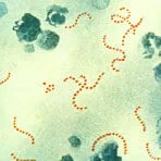 Streptococcus